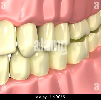 Les fumeurs de mauvaises dents jaunes - concept 3d illustration Banque D'Images