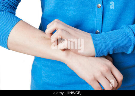 Close Up of Woman Scratching Armwomanw Banque D'Images
