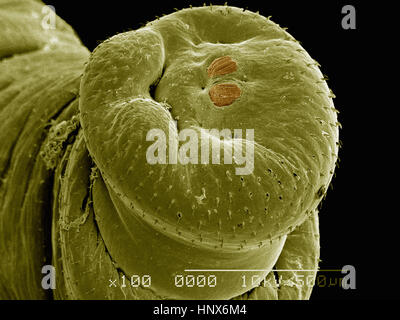 Micrographie électronique à balayage de la partie postérieure de spiracles d'un bot fly (Diptera : Dermatobia sp.) Banque D'Images