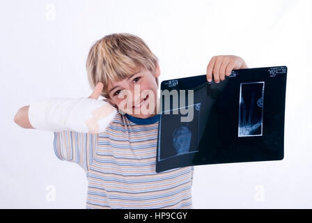 Junge, 11, Gipshand Roentgenaufnahme und mit - garçon au bras dans le plâtre et x-ray Banque D'Images