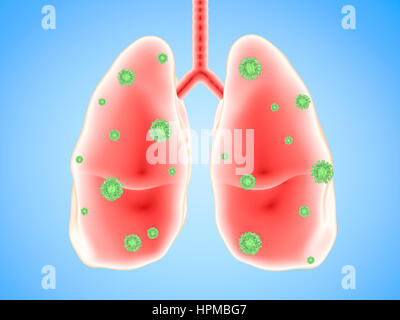 La maladie pulmonaire de rendu 3D avec les cellules des bactéries Banque D'Images