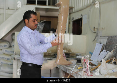 23 février 2017 - amputés à cause de la guerre au Yémen recevoir des prothèses dans un hôpital de la ville yéménite de Taiz Crédit : Abdulnasser/Alseddik ImagesLive/ZUMA/Alamy Fil Live News Banque D'Images