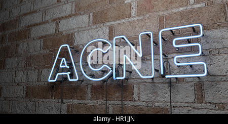 Acné - Glowing Neon Sign sur mur en pierre - rendu 3D illustration libres de droits. Peut être utilisé pour des bannières publicitaires en ligne et de publipostage. Banque D'Images