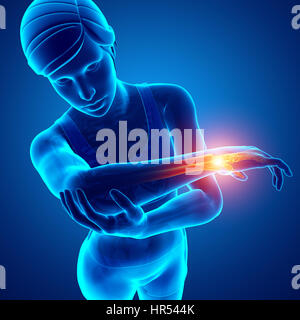 Illustration 3d de la femme le sentiment de la douleur au poignet Banque D'Images