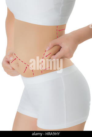 L'accaparement de femme peau sur sa hanche et le ventre avec le dessin des flèches rouges, perdre du poids et la cellulite liposuccion dépose concept, Isolated on white background Banque D'Images