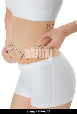 L'accaparement de femme peau sur sa hanche et le ventre avec le dessin des flèches noires, perdre du poids et la cellulite liposuccion dépose concept, Isolated on white backg Banque D'Images