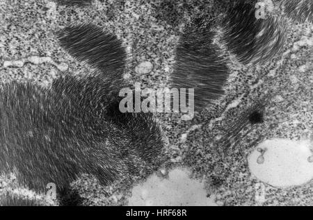 La rhizomanie Virus jaune Banque D'Images