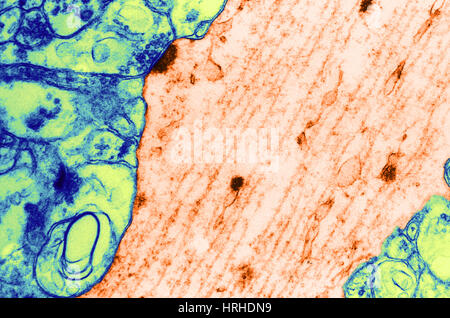 Microtubules dans les axones des nerfs Banque D'Images