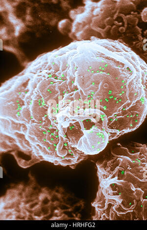 Patients infectés par le VIH-1 des lymphocytes T4, SEM Banque D'Images