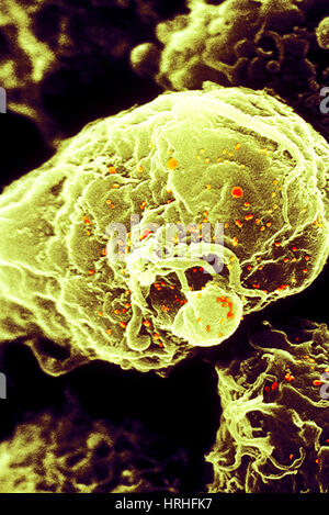 Patients infectés par le VIH-1 des lymphocytes T4, SEM Banque D'Images