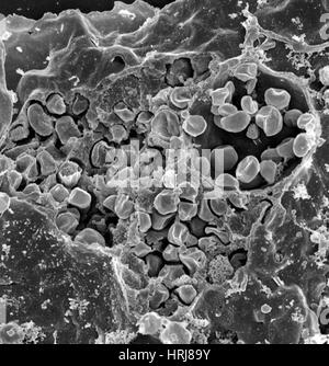 Macrophage infecté par la bactérie Francisella tularensis, SEM Banque D'Images