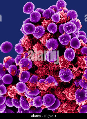 Les bactéries Staphylococcus epidermidis, SEM Banque D'Images