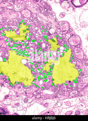 Virus de la rage, TEM Banque D'Images