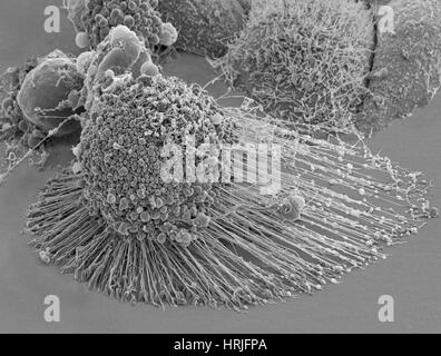 Apoptose des cellules HeLa, SEM Banque D'Images