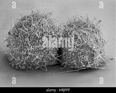 La division de cellules HeLa, SEM Banque D'Images