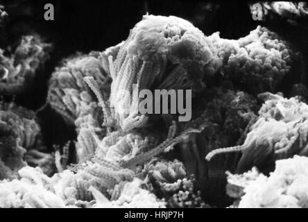 Champignon Aspergillus, SEM Banque D'Images