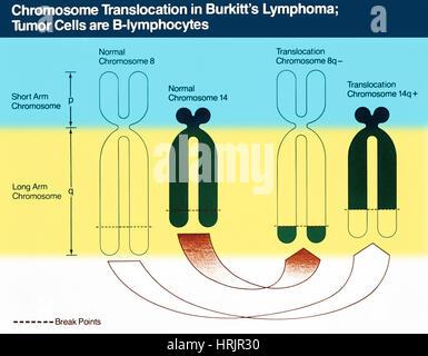 Le lymphome de Burkitt, schéma chromosomique Banque D'Images