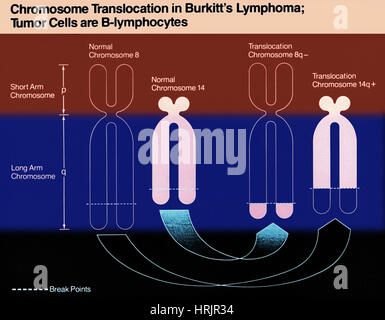 Le lymphome de Burkitt, schéma chromosomique Banque D'Images