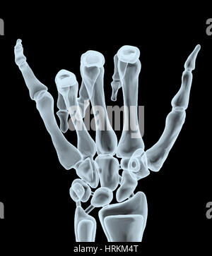 X-ray part faire hangloose geste, 3d illustration Banque D'Images