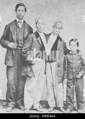 Chang et Eng, Les Jumeaux Siamois d'origine Banque D'Images