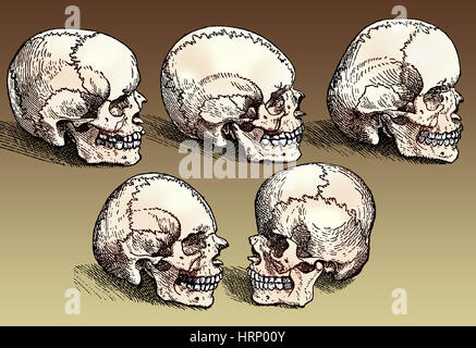 Crânes normaux et anormaux, 16e siècle Banque D'Images