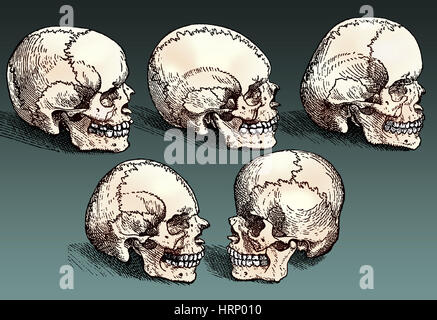 Crânes normaux et anormaux, 16e siècle Banque D'Images