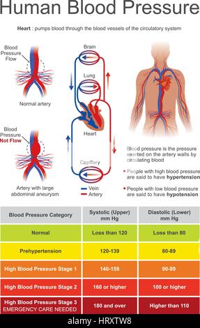 La pression artérielle est la pression du sang circulant sur les parois des vaisseaux sanguins. Lorsqu'il est utilisé sans autre spécification, 'hypertension' usua Illustration de Vecteur