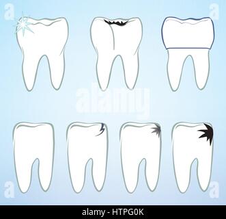 Jeu de dents. les dents blanches signe. médical dentaire colection isolés. Illustration de Vecteur