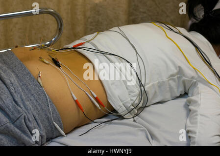 Un patient recevant electro acupuncture, Hong Kong, Chine. Banque D'Images