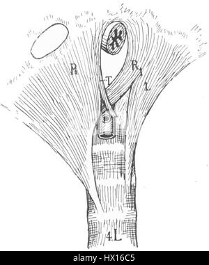 Les crura sont la partie inférieure de la jambe, en particulier la région du tibia. Il comprend les os, les muscles et les tendons qui jouent un rôle important dans le mouvement et le soutien du bas du corps. Le terme est souvent utilisé en anatomie pour décrire la partie de la jambe qui s'étend du genou à la cheville. Banque D'Images