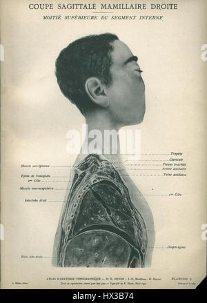 Illustration schématique du côté droit du corps montrant son anatomie de par Atlas d'anatomie topographique Eugene-Louis doyen (1859-1916), 1911. La permission de la National Library of Medicine. Banque D'Images