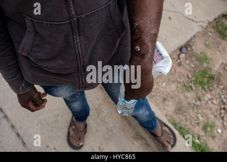 Abri pour les Haïtiens. Tijuana, Mexique - 14/02/2017 - Mexique / Basse Californie / Tijuana - beaucoup d'haïtiens disent qu'ils ont été battus et volés plusieurs fois au cours de la voyage périlleux de Hayti à Tijuana. L'un dit ce qu'il avait été attaqué et pillé à jours avant d'atteindre le logement à Tijuana - Alexandre Afonso / Le Pictorium Banque D'Images