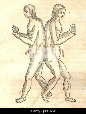 Ambroise Paré, un chirurgien français pionnier, a documenté des jumeaux conjoints dans cette illustration médicale du XVIe siècle. Le travail de Paré reflète ses contributions importantes à la médecine moderne précoce et ses efforts pour faire progresser les techniques chirurgicales. Banque D'Images