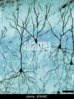 Un neurone pyramidale de Betz, un type de grande cellule nerveuse dans le cortex moteur du cerveau. Banque D'Images