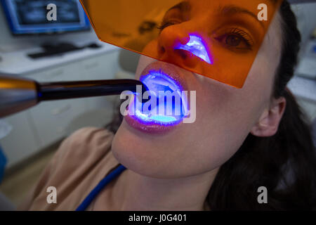 Examinant les dentistes female patient avec lampe à polymériser dentaire en clinique Banque D'Images