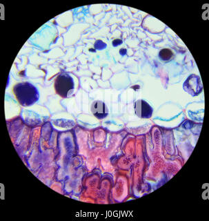 Aiguille de pin cross-section sous le microscope, l'arrière-plan, (Pinus) Banque D'Images