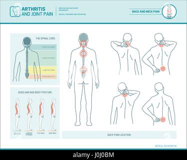 Les maux de dos et la posture corporelle infographie avec illustrations anatomiques Illustration de Vecteur