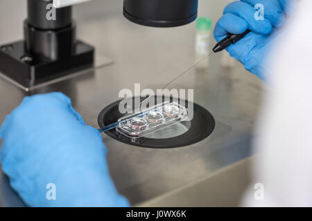 Contrôle de résultat de la fécondation in vitro Banque D'Images