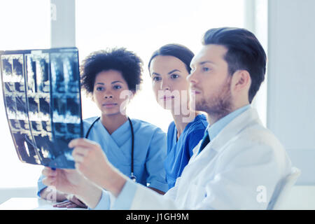 Groupe de médecins à la recherche d'x-ray à l'hôpital Banque D'Images