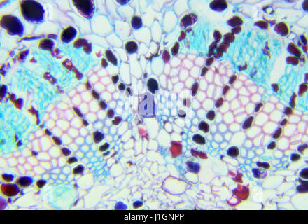 Aiguille de pin cross-section sous le microscope, l'arrière-plan, (Pinus) Banque D'Images