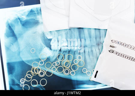 Beaucoup de cabinets dentaires dents Orthodontie accolades bagues en caoutchouc latex sur xray de mâchoires Banque D'Images