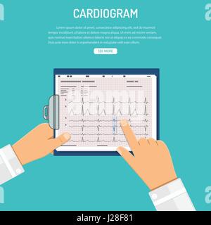 Presse-papiers en mains sur le cardiogramme de médecin Illustration de Vecteur