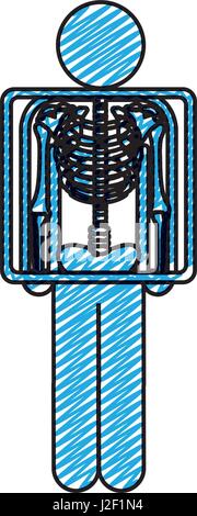 Dessin au crayon de couleur de pictogramme et la radiographie du patient Illustration de Vecteur