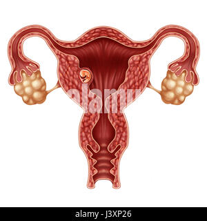 Les droits de l'embryon implanté concept et grossesse à l'implantation dans l'utérus comme un foetus dans un corps féminin comme l'obstétrique. Banque D'Images