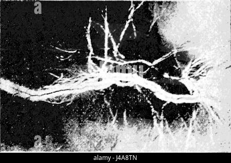 PSM V49 D325 décharge d'une machine wimshurst Banque D'Images