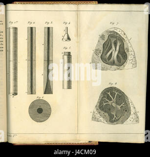 René Théophile Hyacinthe Laennec (1781 1826) Dessins stéthoscope et poumons Banque D'Images