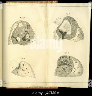 René Théophile Hyacinthe Laennec stéthoscope 1819 Dessins Photo Stock ...