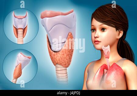 Illustration d'un enfant du cartilage thyroïde. Banque D'Images