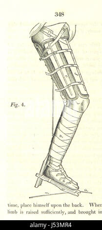 Ce travail traite du traitement médical des fractures du tronc et des extrémités, offrant des conseils pratiques sur le diagnostic, les soins et les méthodes de traitement. Le texte couvre différents types de fractures, leur prise en charge et les considérations chirurgicales. Banque D'Images