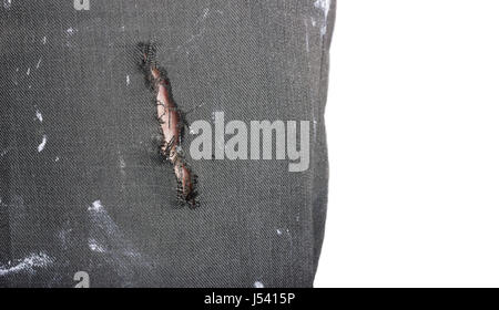 Trou dans le pantalon d'un travailleur avec la peau des cheveux de jambe devant isolé sur fond blanc Banque D'Images